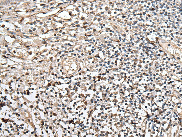 Immunohistochemistry of paraffin-embedded Human tonsil tissue  using UTP3 Polyclonal Antibody at dilution of 1:40(?200)