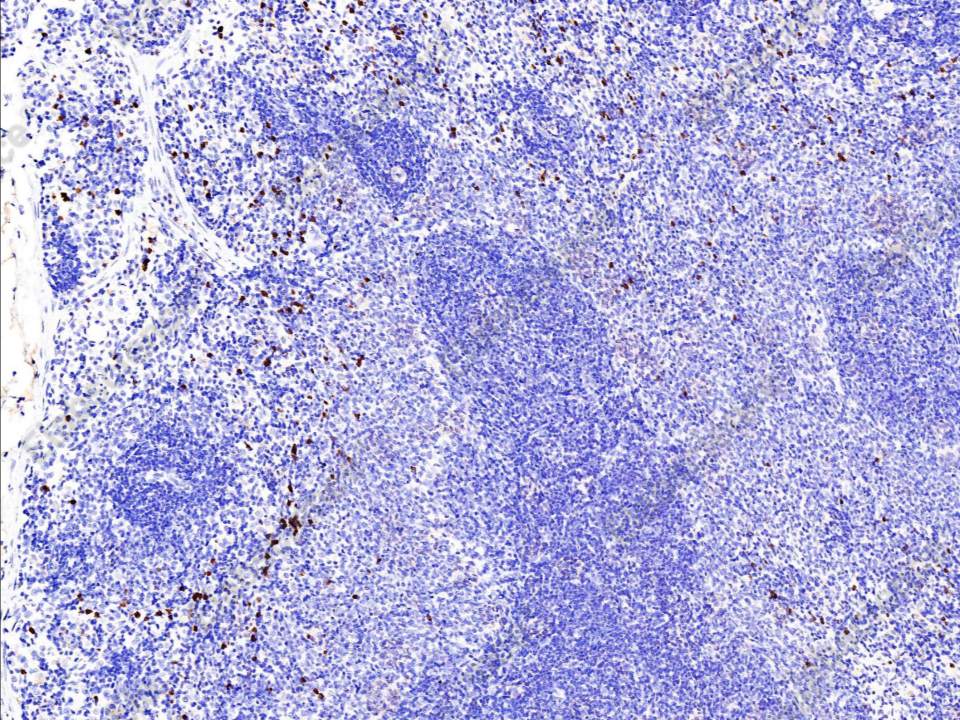 Recombinant S100A9 Monoclonal Antibody - 2