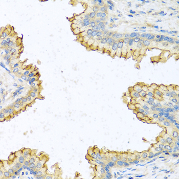 Immunohistochemistry of paraffin-embedded human prostate using RNASE13 Polyclonal Antibody at dilution of 1:100 (40x lens).Perform microwave antigen retrieval with 10 mM PBS buffer pH 7.2 before commencing with IHC staining protocol.