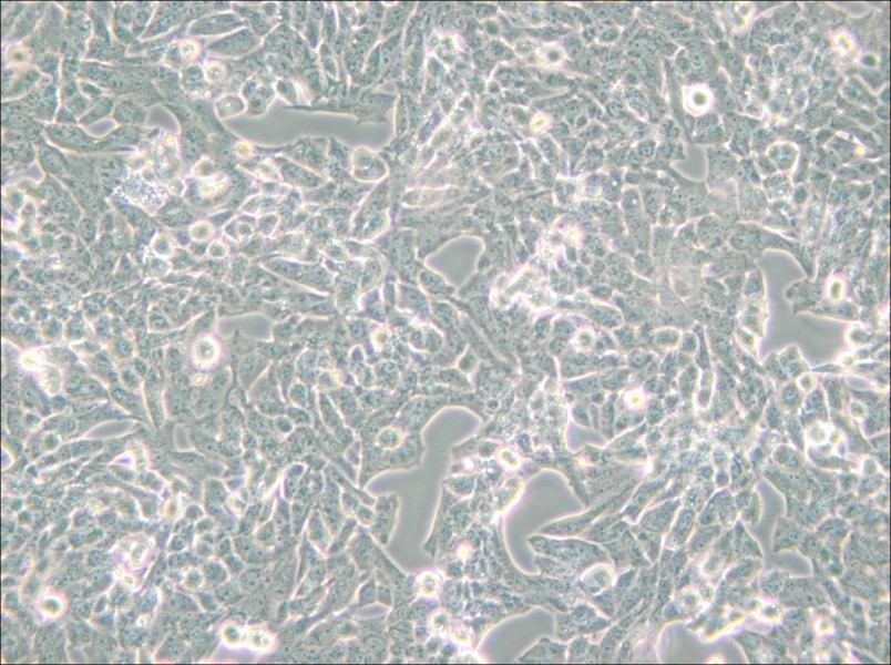 NCI-H295R Cell Complete Medium - 6