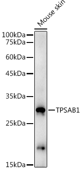 Western blot analysis of extracts of Mouse skin using TPSAB1 Polyclonal Antibody at 1:1000 dilution.