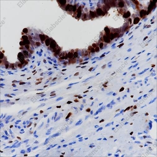 Recombinant Progesterone Receptor Monoclonal Antibody - 2
