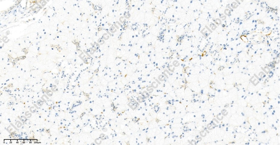 Recombinant EGFR Monoclonal Antibody - 2