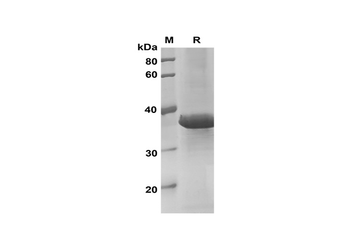 Recombinant Mouse IL-33 Protein(Trx Tag)-产品推荐-1