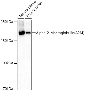 Western blot analysis of various lysates using Alpha-2-Macroglobulin (A2M) Polyclonal Antibody at 1:1000 dilution.