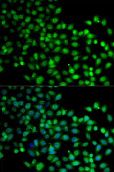 Immunofluorescence analysis of A-549 cells using FKBP6 Polyclonal Antibody Blue: DAPI for nuclear staining.