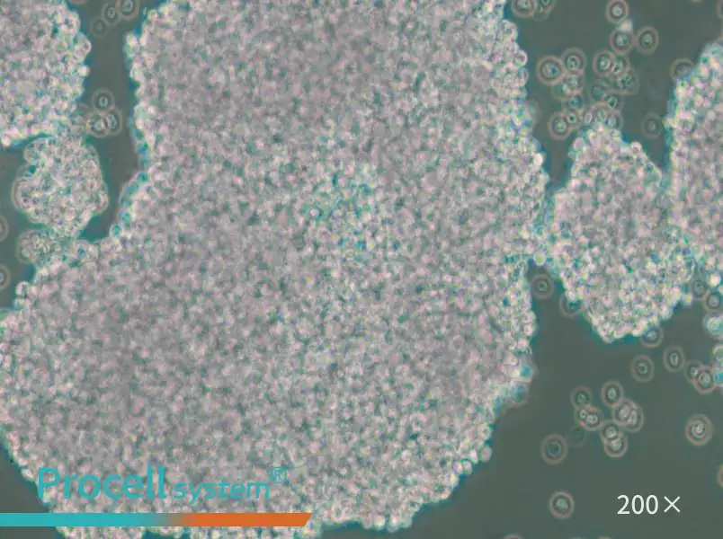 NCI-H1417 Cell Complete Medium - 4