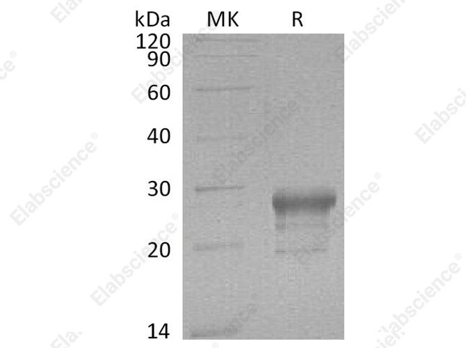 Recombinant Human PGD2 Synthase/PTGDS Protein (His Tag) - 1