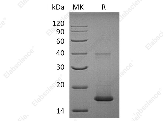 Recombinant Human IL1F10/IL-38 Protein - 1