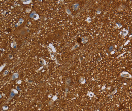 SNCG Polyclonal Antibody - 2