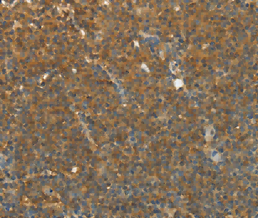 TEKT1 Polyclonal Antibody - 2
