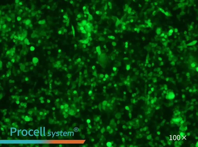 RM-1-GFP Cell Complete Medium - 1