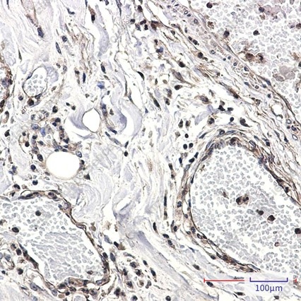 Recombinant CAB39 Monoclonal Antibody - 4