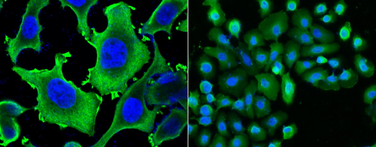 Recombinant HSP27/HSPB1 Monoclonal Antibody-searchlist-1