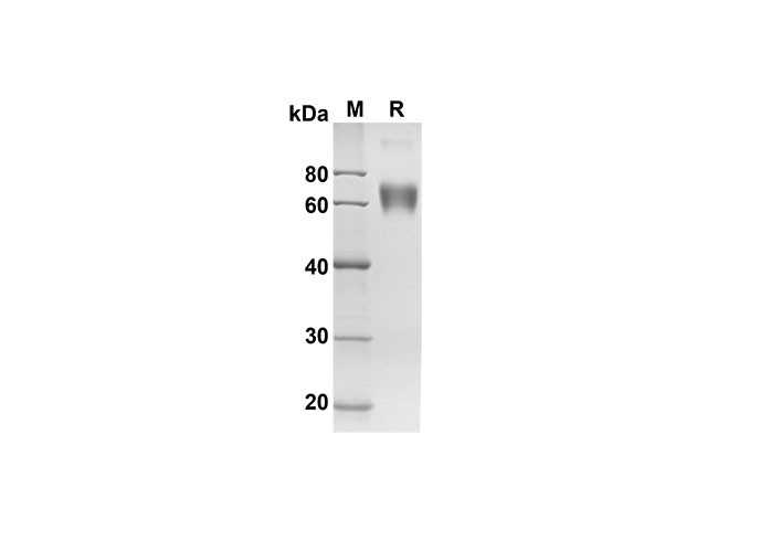 Recombinant Mouse TNF-α Protein(His Tag)-产品推荐-1