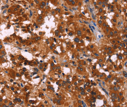 RPSA Polyclonal Antibody - 2