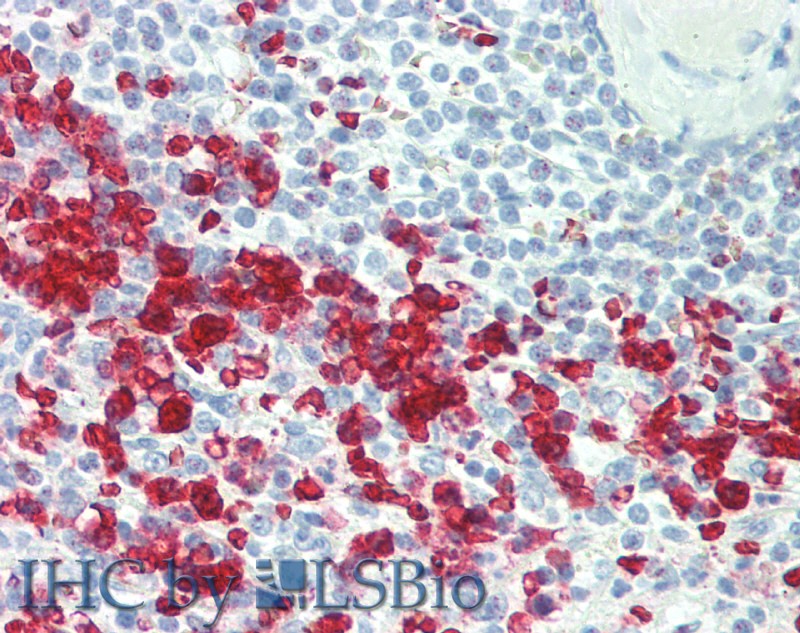 Immunohistochemistry of paraffin-embedded Spleen tissue using CCL17 Polyclonal Antibody at dilution of 1:100 (Elabscience Product Detected by Lifespan).