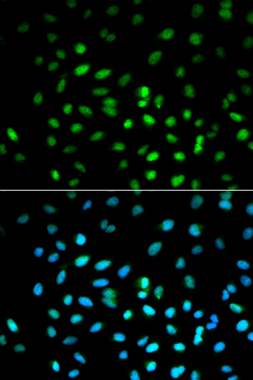 Immunofluorescence analysis of MCF-7 cells using LKB1 Polyclonal Antibody