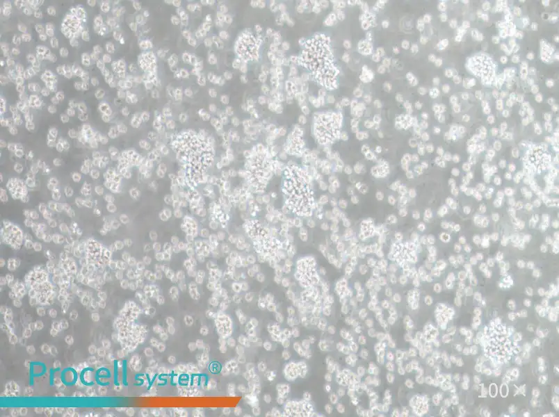 SU-DHL-6 Cell Complete Medium - 1