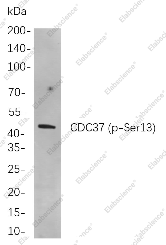 Recombinant Phospho-CDC37 (Ser13) Monoclonal Antibody - 1