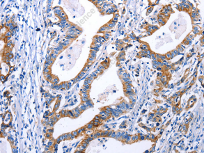 DRD4 Polyclonal Antibody - 3