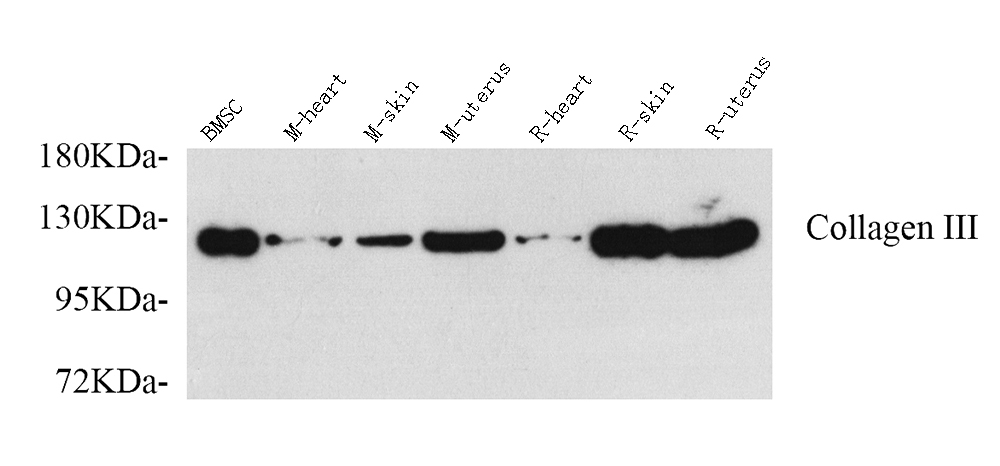 Western Blot analysis of various samples using COL3A1 Polyclonal Antibody at dilution of 1:750.