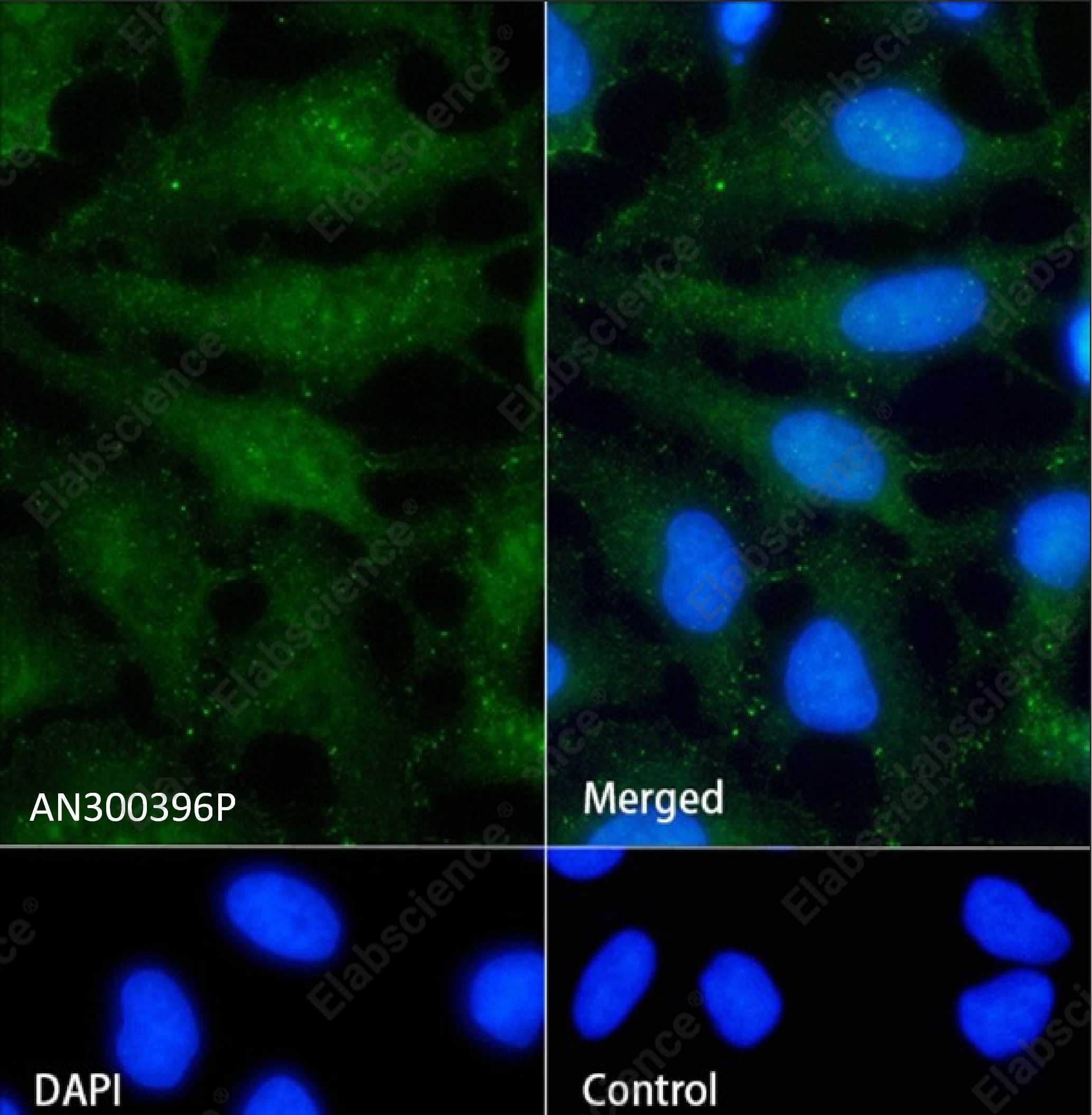 Recombinant beta-Catenin/CTNNB1 Monoclonal Antibody - 2