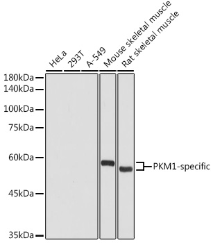 Western blot analysis of extracts of various cell lines using PKM1-specific Polyclonal Antibody at 1:1000 dilution.