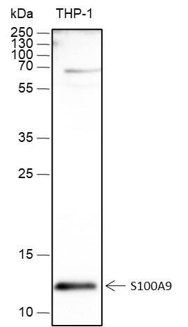 Recombinant S100A9 Monoclonal Antibody-searchlist-1
