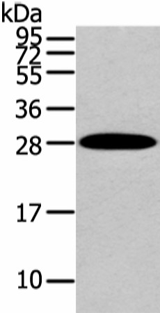 Western Blot analysis of Human liver cancer tissue using ZNF365 Polyclonal Antibody at dilution of 1/200