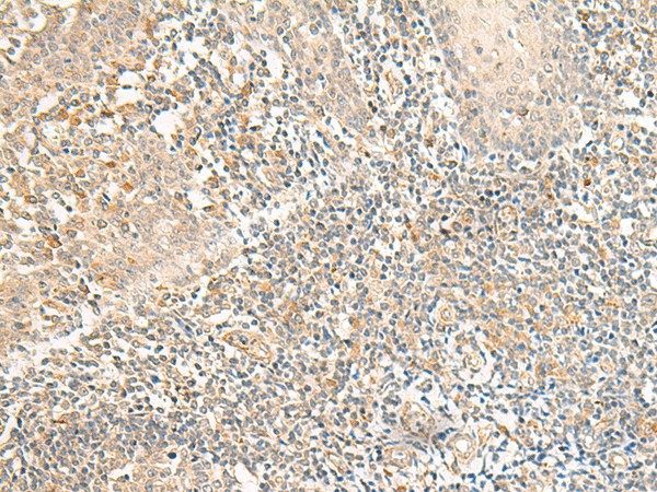 Immunohistochemistry of paraffin-embedded Human tonsil tissue  using GPR157 Polyclonal Antibody at dilution of 1:50(?200)