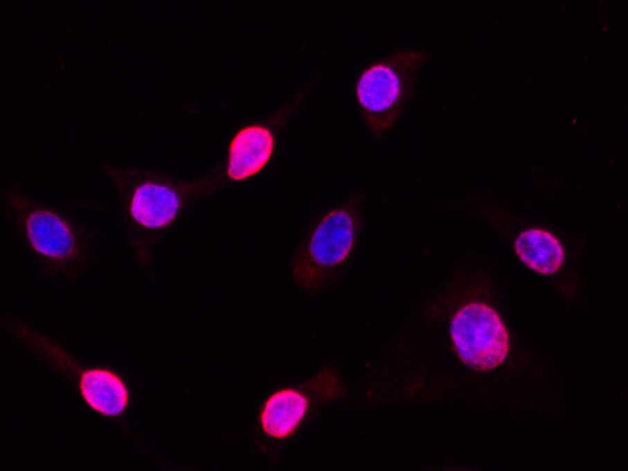 Purified Anti-Human CD371 Antibody[50C1]-产品推荐-1
