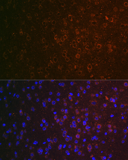 Immunofluorescence analysis of mouse brain using GABA transaminase (GABA transaminase (ABAT)) Polyclonal antibody at dilution of 1:100 (40x lens). Blue: DAPI for nuclear staining.