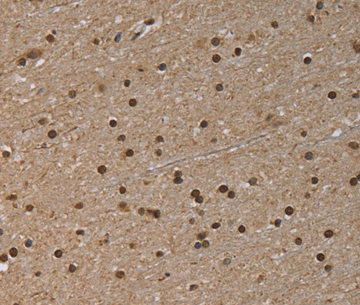 Immunohistochemistry of paraffin-embedded Human brain  tissue using NLRP6 Polyclonal Antibody at dilution 1:50