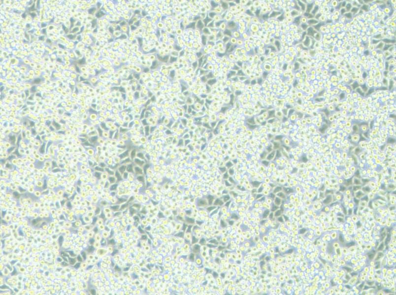 NCI-H2122 Cell Complete Medium-searchlist-1