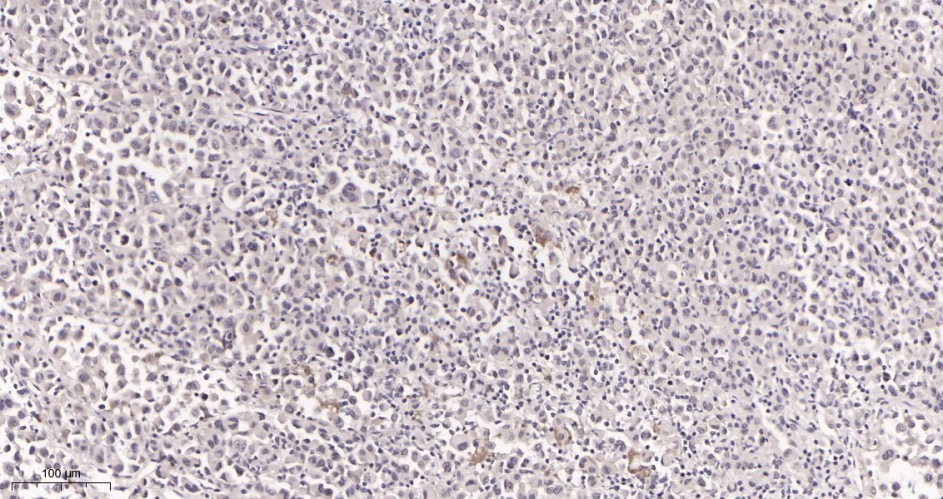 Recombinant MiTF Monoclonal Antibody - small - 2