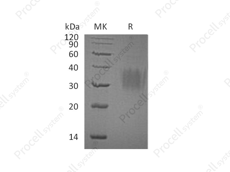 IL-9/Cytokine P40 (C-6His), Human, Recombinant