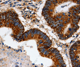 HSP75 Polyclonal Antibody - 2