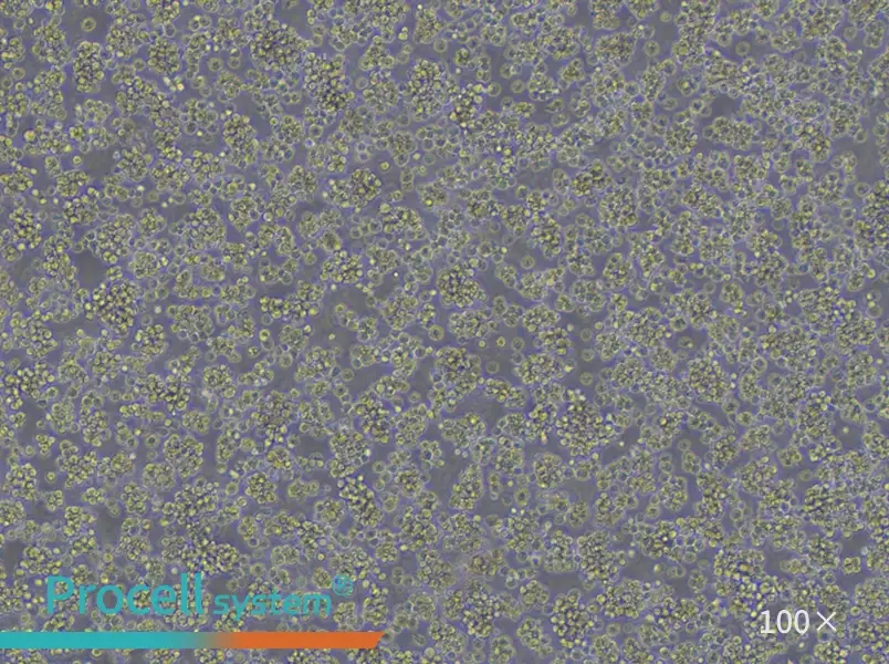 Jurkat, Clone E6-1 Cell Complete Medium - 1