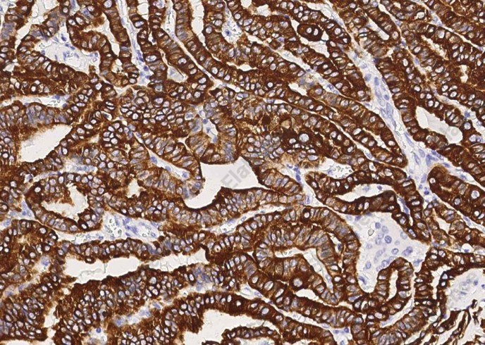 KRT19 Monoclonal Antibody - 1