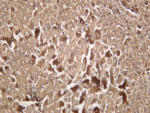 Recombinant Acetyl Lysine Monoclonal Antibody - 2