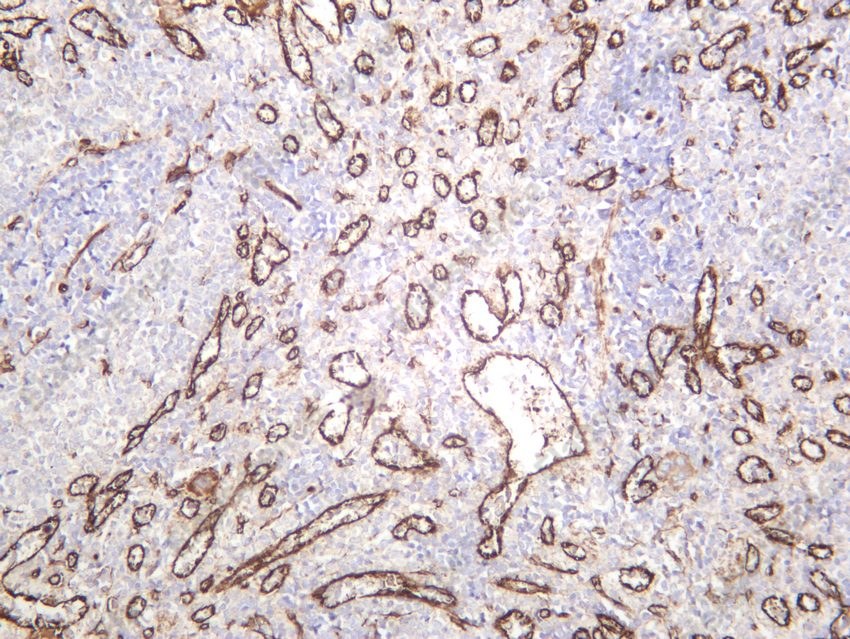 Recombinant ZO1 Monoclonal Antibody - 5