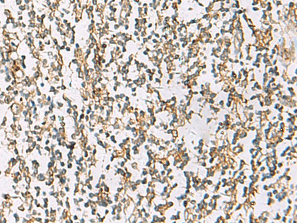 Immunohistochemistry of paraffin-embedded Human tonsil tissue  using ZPBP2 Polyclonal Antibody at dilution of 1:80(?200)