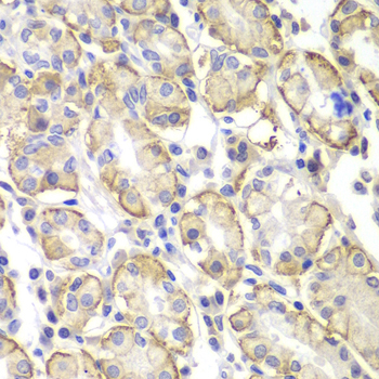 Immunohistochemistry of paraffin-embedded Human stomach using Lyn Polyclonal Antibody at dilution of 1:100 (40x lens).