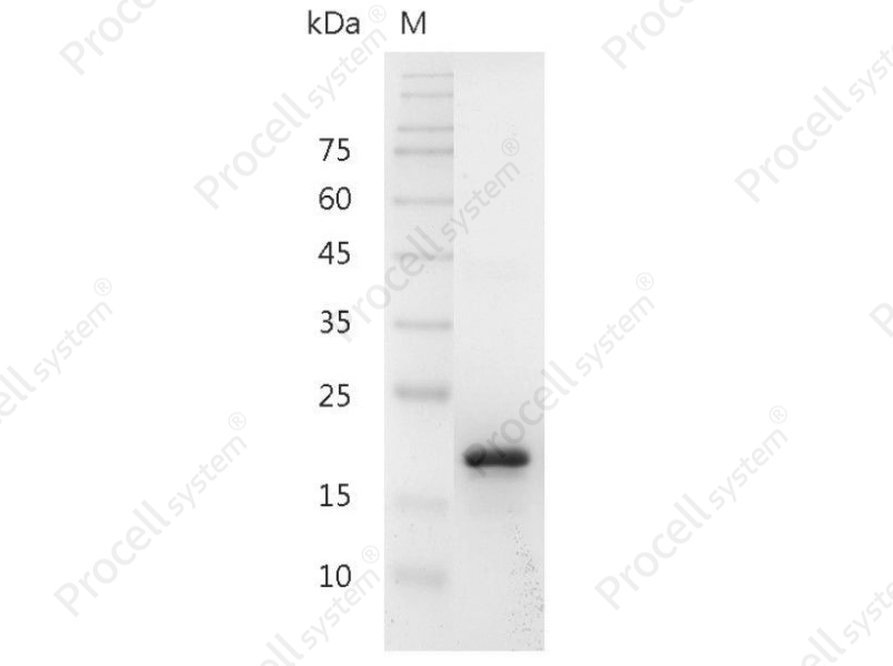 BAFF/TALL-1, Mouse, Recombinant
