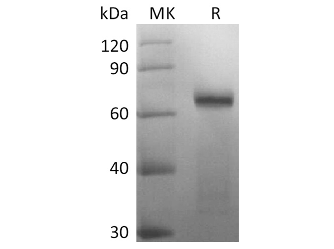 Recombinant 2019-nCoV Spike Protein (RBD-SD1, mFc Tag)