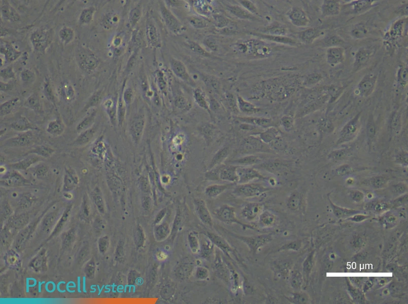 Human Pulmonary Arteriolar Endothelial Cell Complete Medium - 6