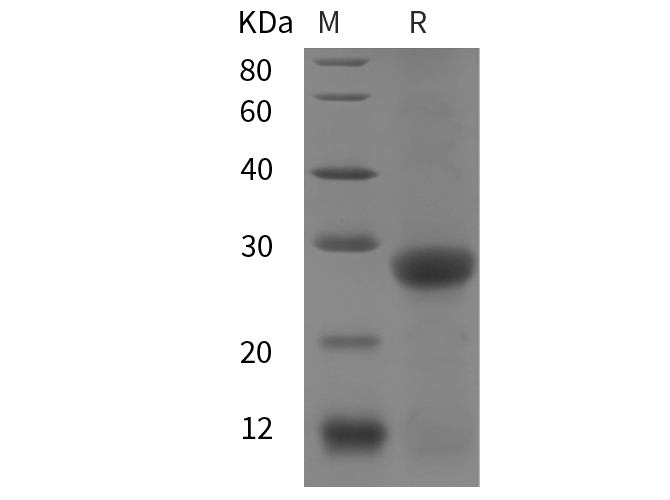 Recombinant Mouse CD86 Protein(Fc Tag)-产品推荐-1