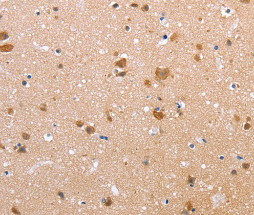 Immunohistochemistry of paraffin-embedded Human brain tissue using Claudin 10 Polyclonal Antibody at dilution 1:50