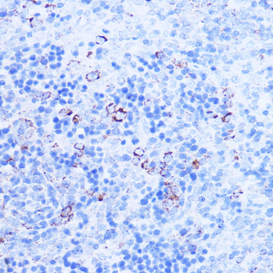 Immunohistochemistry of paraffin-embedded Rat spleen using SHMT2 Polyclonal Antibody at dilution of 1:100 (40x lens).